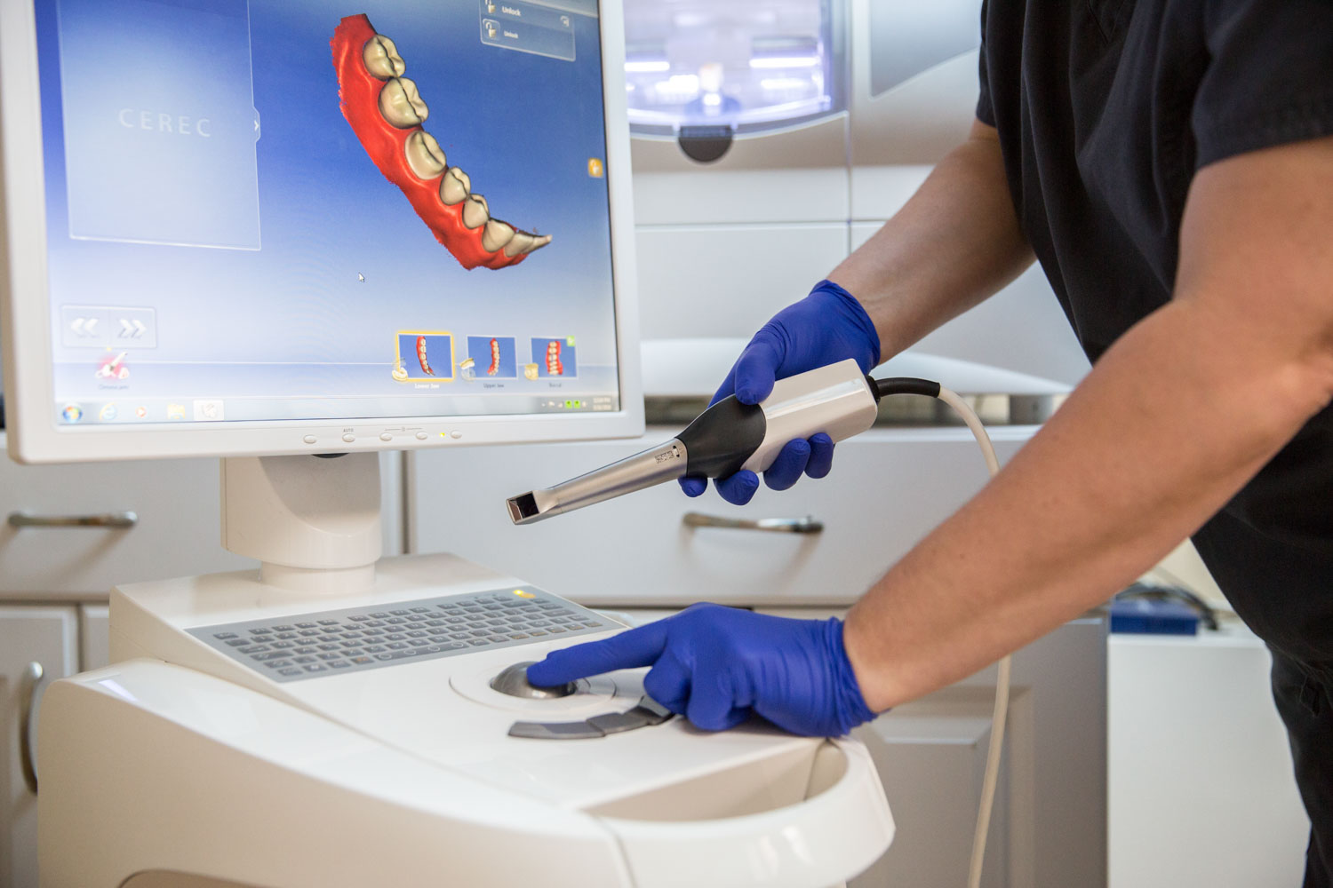 CEREC - Dental Technology Image